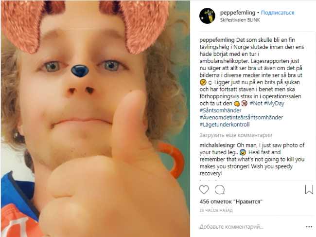 Олимпийский чемпион по биатлону вогнал себе в ногу лыжную палку